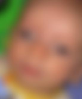 World Eye Cancer Hope | Charici